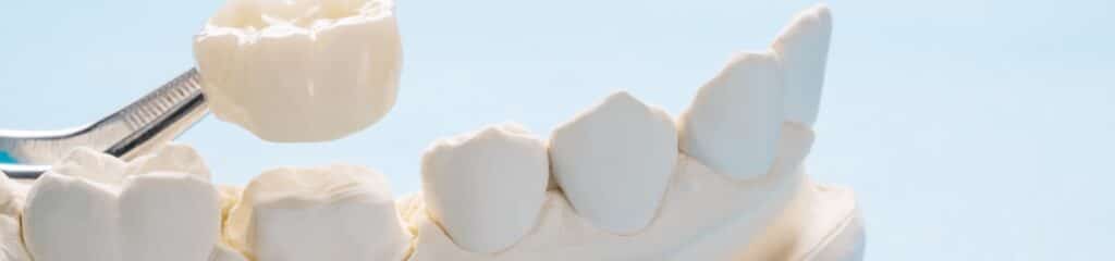 Dental Crowns Loris SC