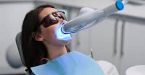 Teeth,Whitening,For,Woman.,Bleaching,Of,The,Teeth,At,Dentist