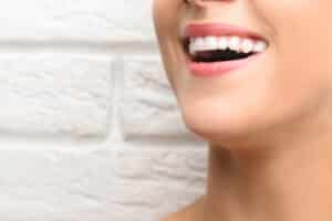 A woman smiling and showing straight teeth from dental bonding.