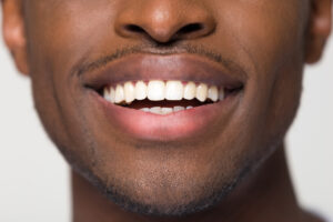 Handsome man smiles to show off his perfect teeth, which have been enhanced with porcelain veneers.